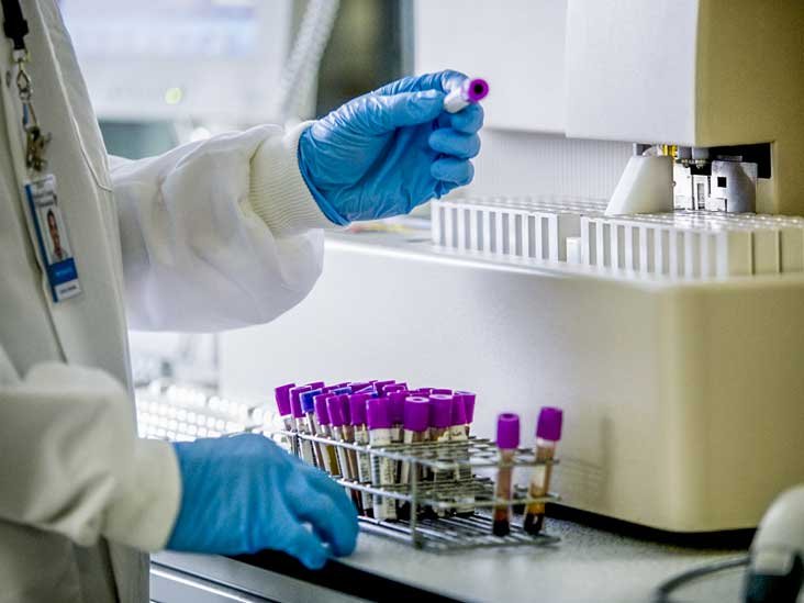 Un nouveau test sanguin pourrait détecter plusieurs types de cancer à un stade précoce