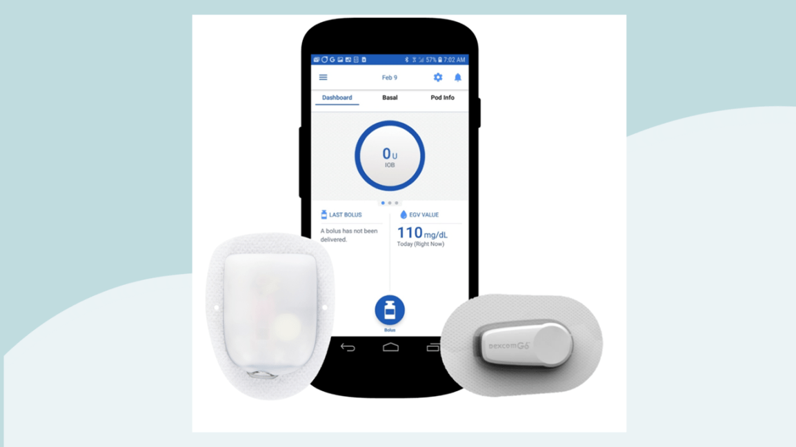 Excitation Building Over Omnipod 5 Système de diabète automatisé avec contrôle par smartphone
