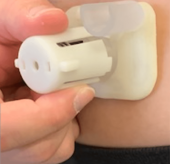 Evopump : une pompe à insuline « patch » flexible semblable à un pansement