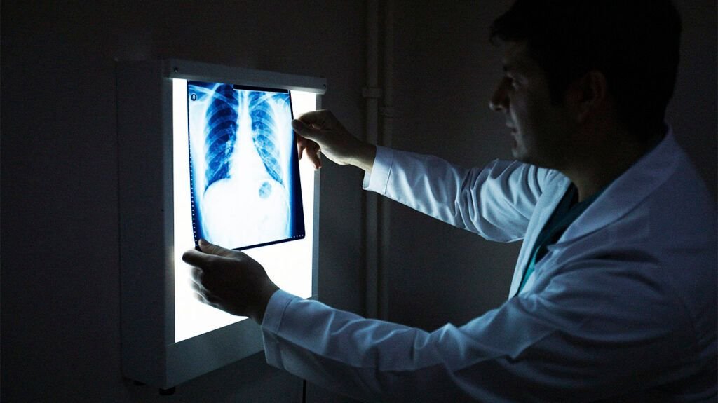 professionnel de la santé regardant une radiographie thoracique